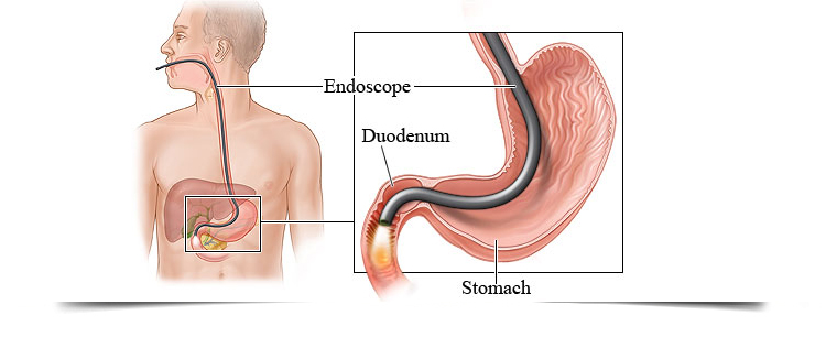 Best Gastroenterologist in Bathinda