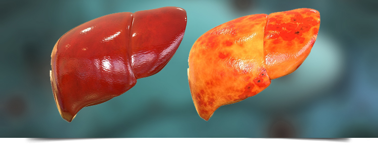 Best Gastroenterologist in Bathinda