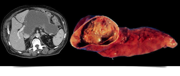 Best Gastroenterologist in Bathinda