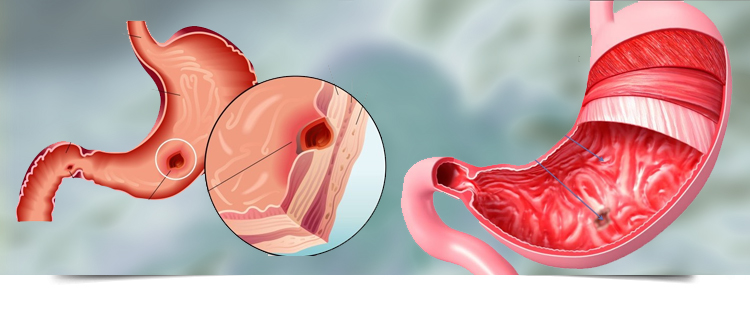 Best Gastroenterologist in Bathinda