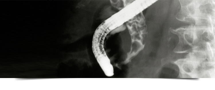 Best Gastroenterologist in Bathinda