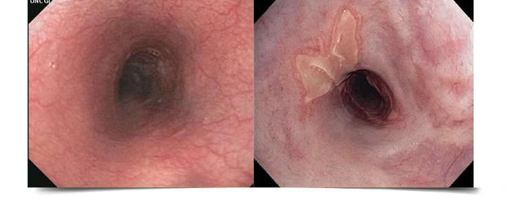 Best Gastroenterologist in Bathinda