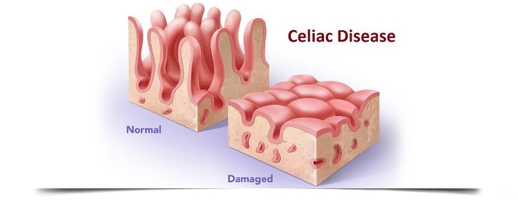 Best Gastroenterologist in Bathinda
