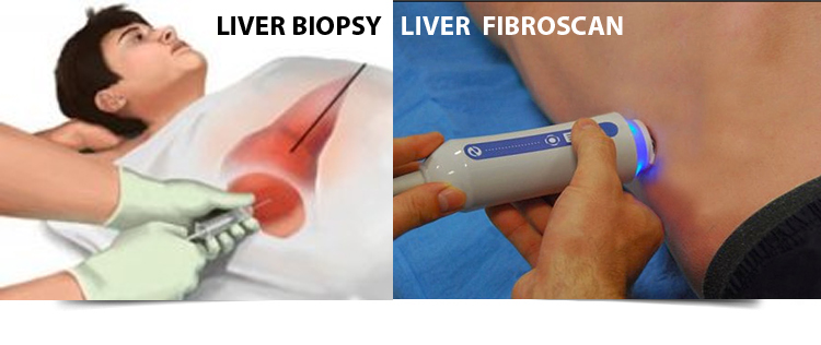 Best Gastroenterologist in Bathinda