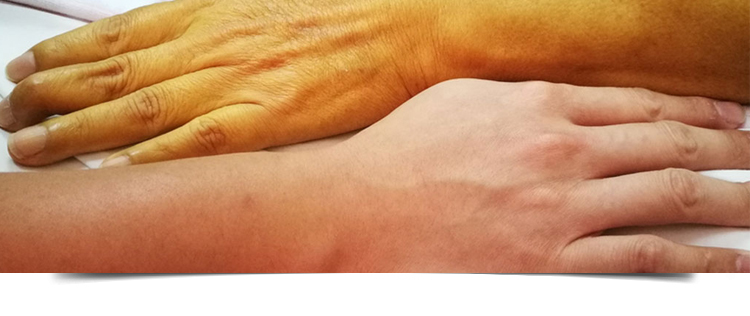 Best Gastroenterologist in Bathinda