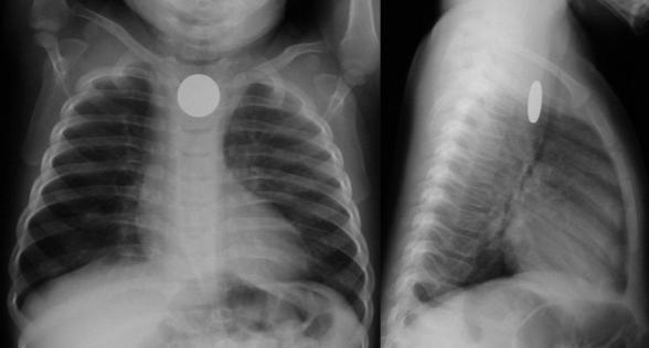 Best Gastroenterologist in Bathinda